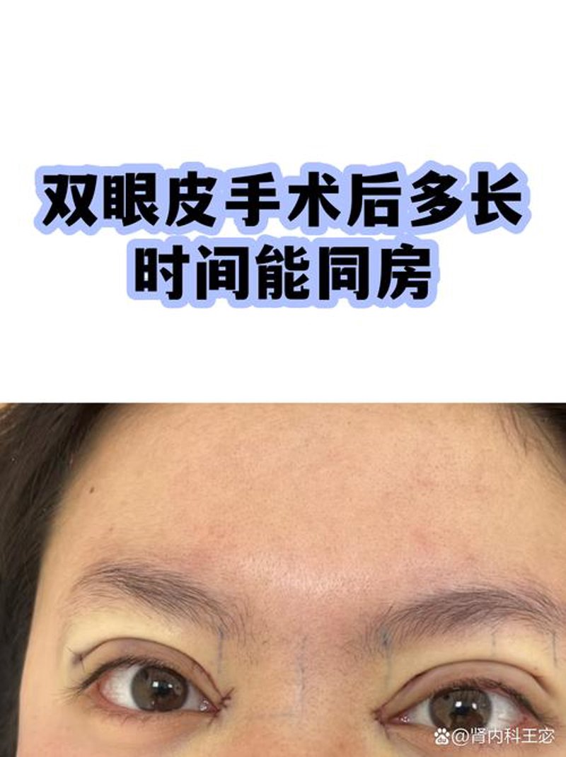 整形美容医院的案例分析:打造完美自我的艺术