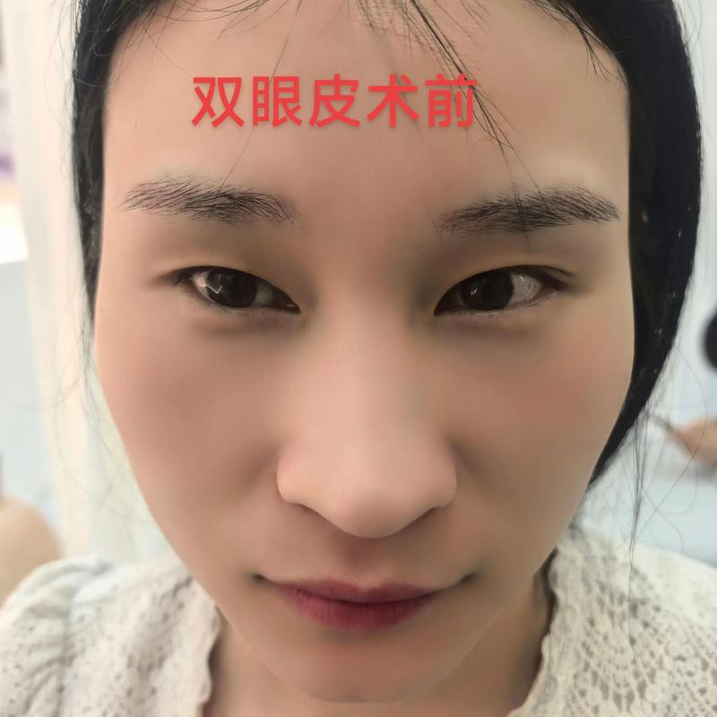 整形咨询